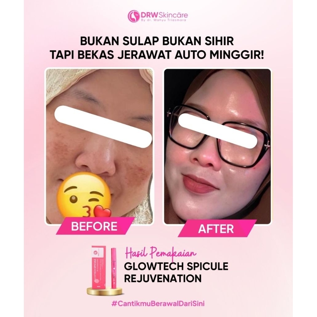 Glowtech Spicule Rejuvenation DRW Skincare