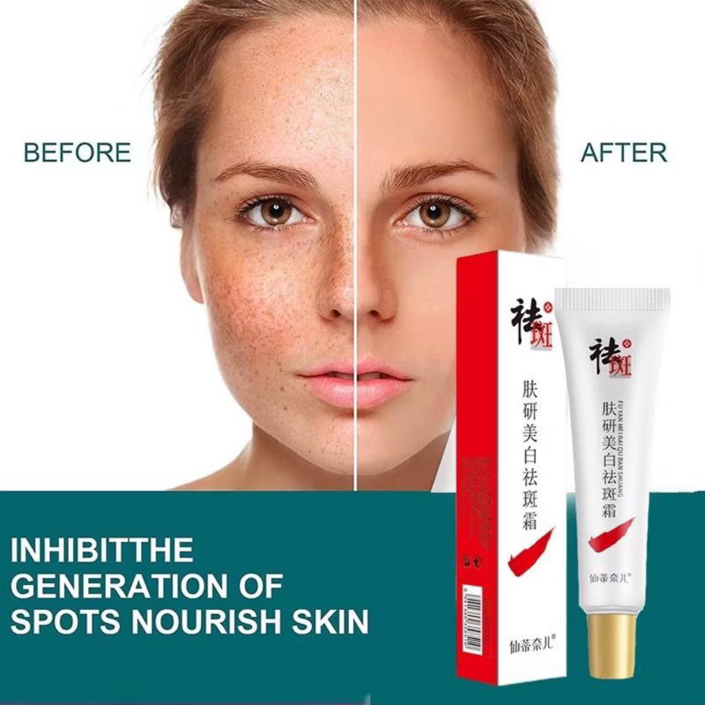 Cream penghilang Flek hitam diwajah