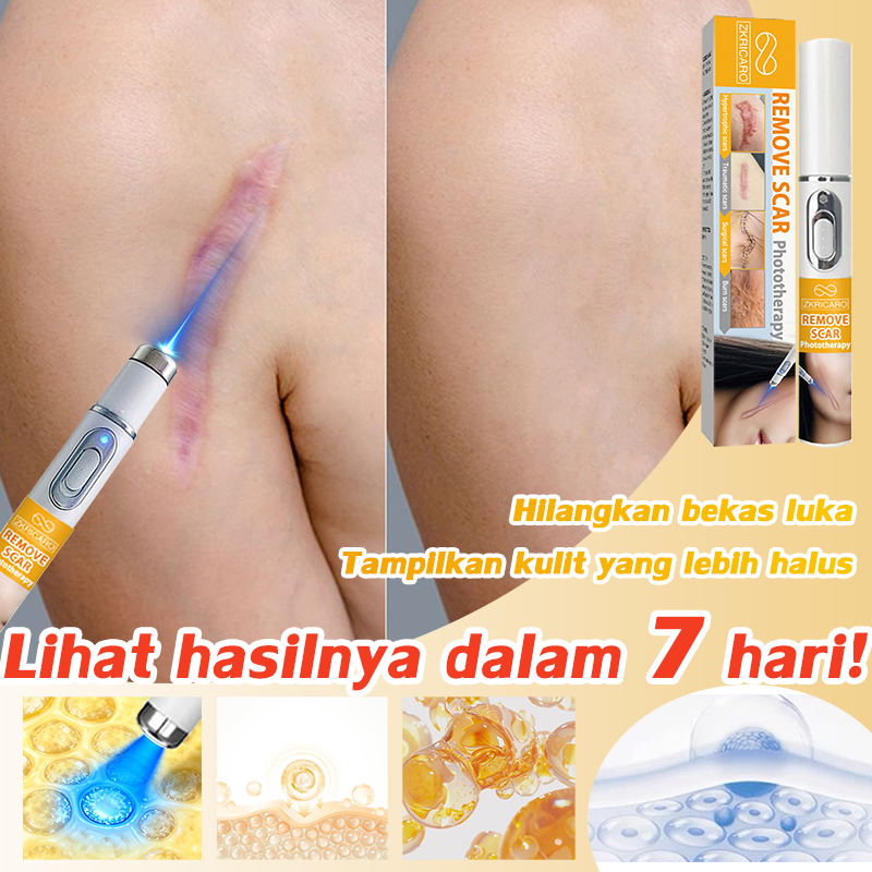Pulpen Laser Penghilang Bekas Luka - Pulpen laser untuk mengobati bekas luka pada kulit dan permukaa