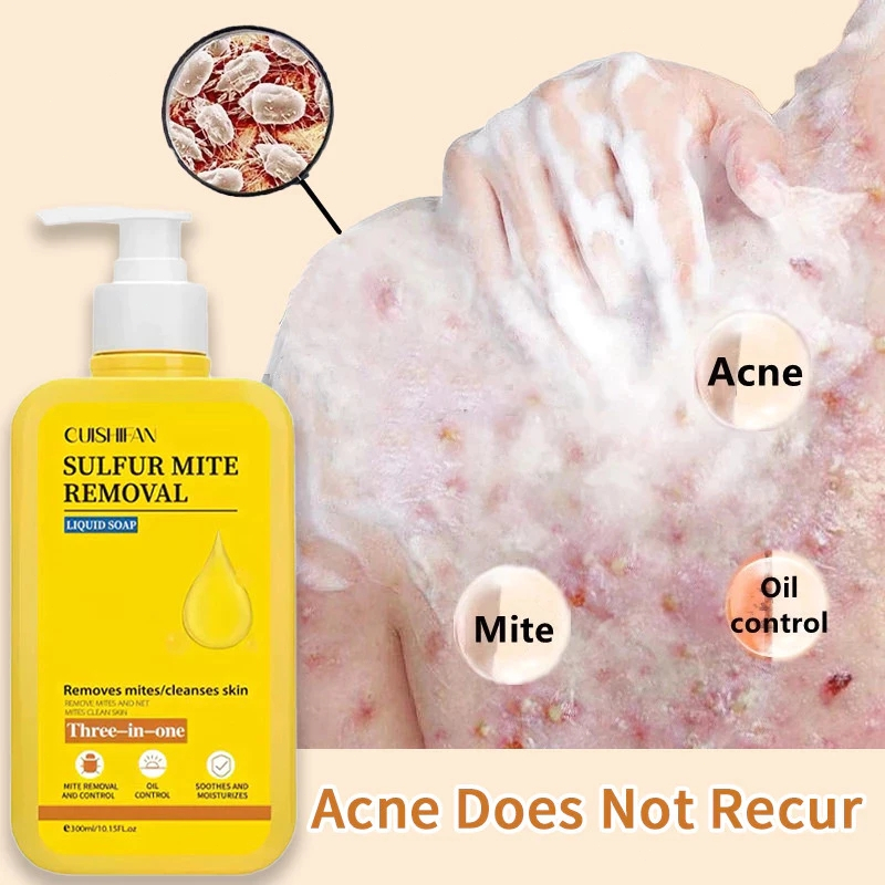 300ml Sabun Sulfur Cair Sabun Gatal Sulfur Sabun Penghilang Tungau Sabun Cair Belerang