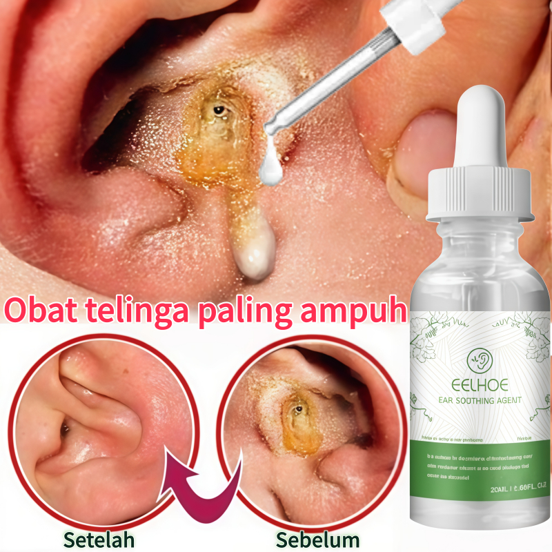 Tetes telinga pembersih kotoran Tetes telinga Pembersih kotoran telinga Tetes telinga berdengung Tet