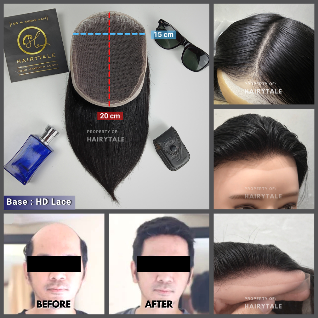 Toupee / tutup botak pria, HD Lace, ukuran custom, Hairytale 100% Human Hair