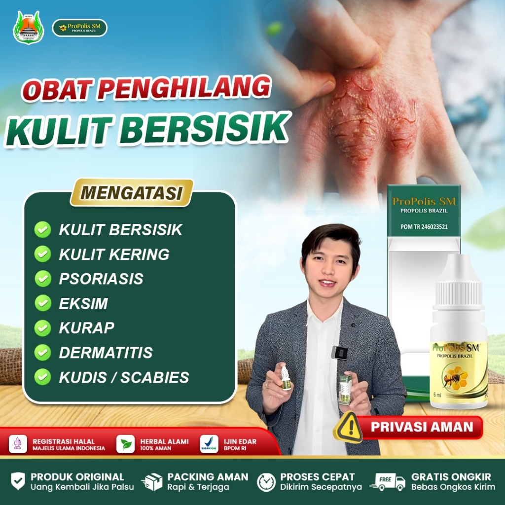 Obat Penghilang Kulit Bersisik, Obat Kulit Kering Bersisik, Obat Gatal Kulit Hitam Bersisik, Obat Ku