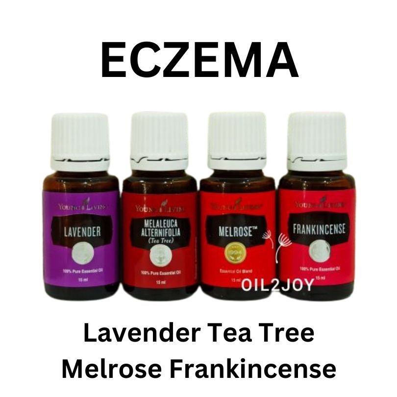 Eczema Blend Melrose Frankincense Lavender Tea Tree YL Essential Oil 5ml 10ml 15ml eksim gatal Roll 