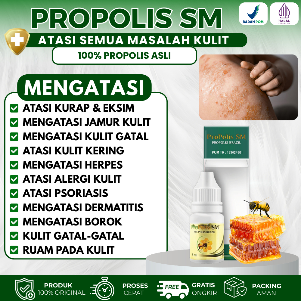 Obat Biduran Pada Anak, Alergi Kulit, Kulit Gatal Gatal, Ruam Kulit, Luka Gatal, Infeksi Jamur Kulit