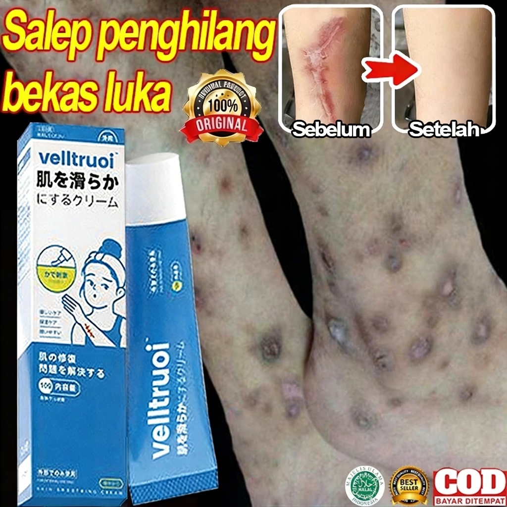 Krim Penghilang Bekas Luka Hitam Koreng Obat Penghilang Bekas Luka Menghilangkan Bekas Jerawat Jahit