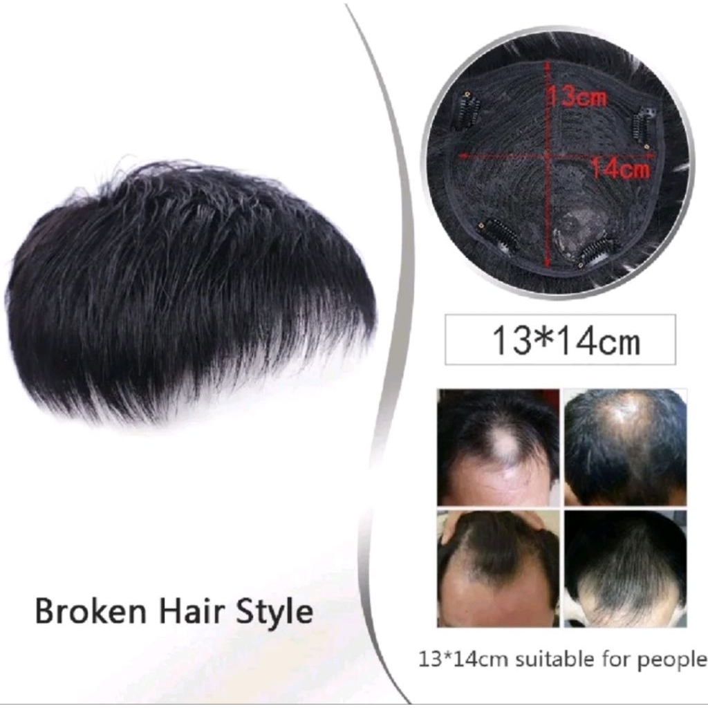 WIG PENUTUP BOTAK PRIA/PENUTUP BOTAK PRIA PENDEK