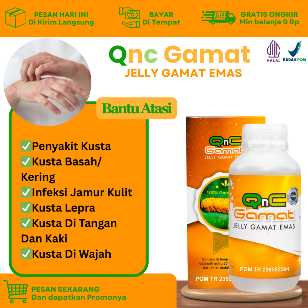 Obat Untuk Penyakit Kusta, Kusta di Tangan, Di Kaki, Di Wajah, Kusta Lepra, Bercak Kulit Hitam, Mera