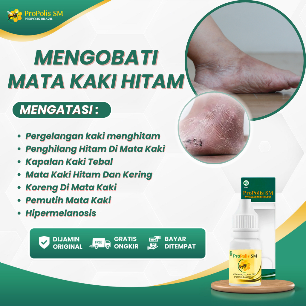 Obat Mata Kaki Hitam, Penghilang Hitam Di Mata Kaki, Kapalan Kaki Tebal, Mata Kaki Hitam Dan Kering,