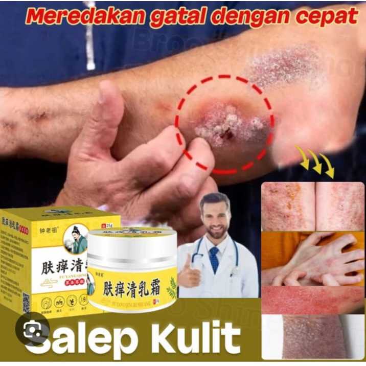 Salep Herbal Ba Tao - Krim Gatal Alami untuk Eksim, Gatal Selangkangan dan Kurap - Formula Cina Trad