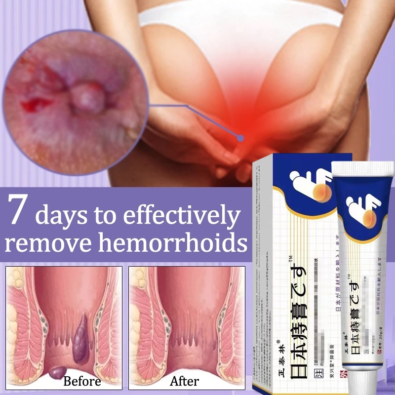 Obat wasir Obat ambeien Salep ambeien paling ampuh salep ambeien obat ambeien paling ampuh mengobati