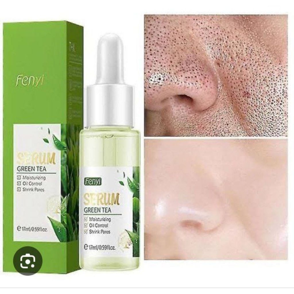 [EXP FEBRUARI 2028] Serum Fenyi Whitening 17ml & Anti-Aging – Hyaluronic + Aloe Vera