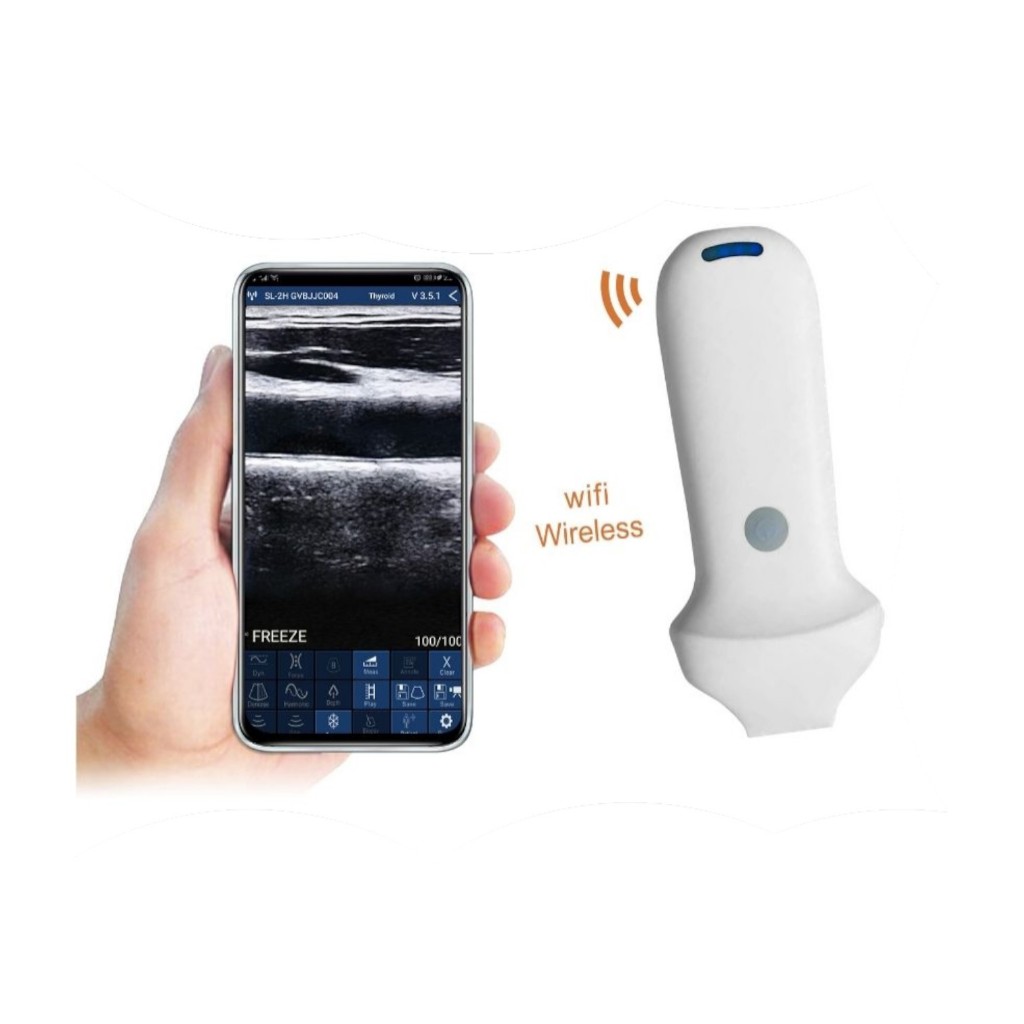 Pemindai Ultrasonografi Probe Linier Wireless Wifi – USG Portable Terhubung ke Smartphone, Tablet, L