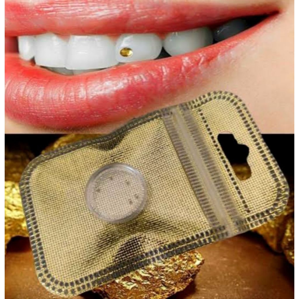 Berlian Gigi Motif Diamond Gigi / kristal Gold / Isi 5