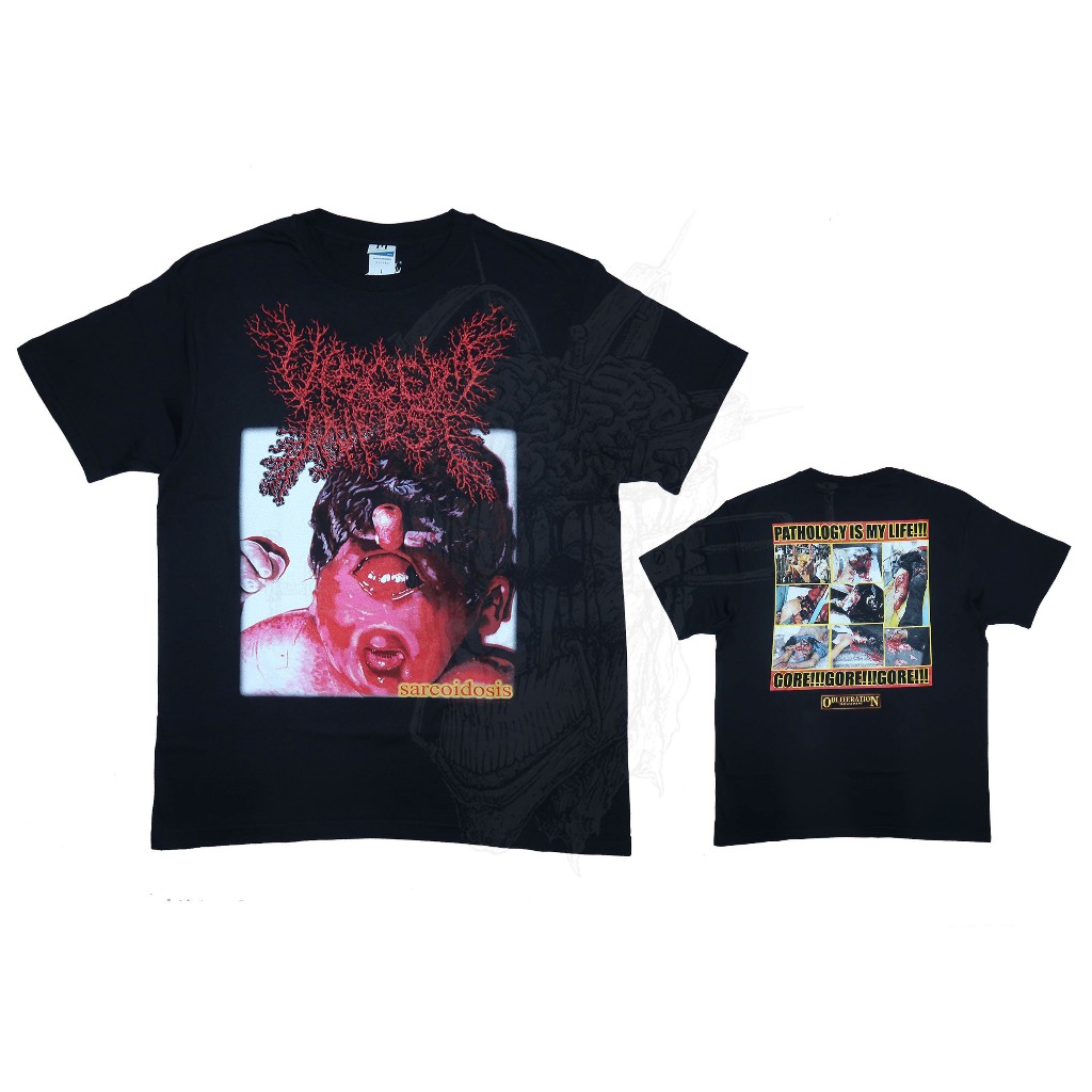 T-Shirt - Viscera Infest - Sarcoidosis