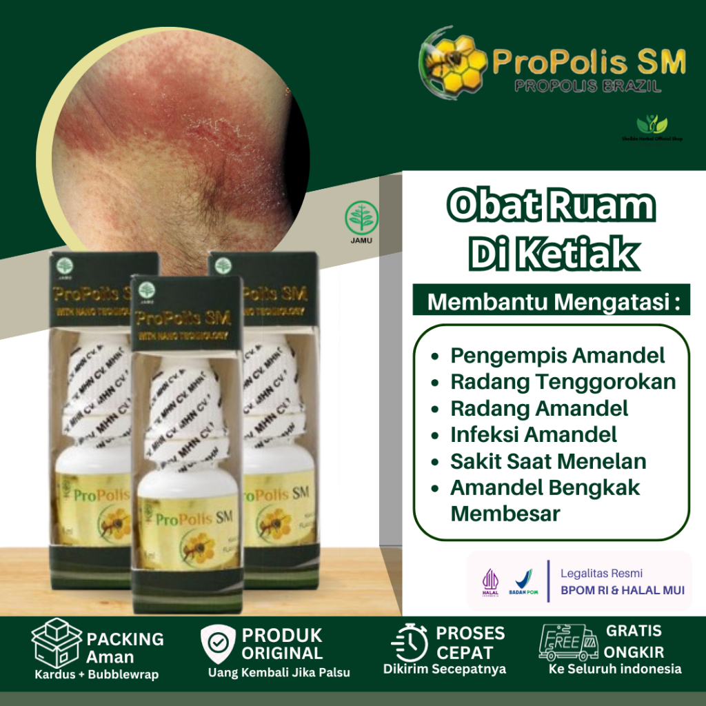 Obat Tetes Untuk Ketiak Gatal, Ruam Di Kulit Ketiak, Ketiak hitam Bau , Oles Eksim Ketiak, Gatal Fol