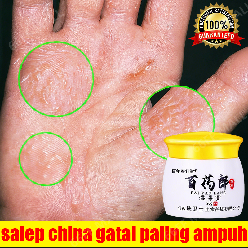 salep china gatal paling ampuh Obat kurap salap gatal kulit yang ampuh obat gatal selangkangan salep