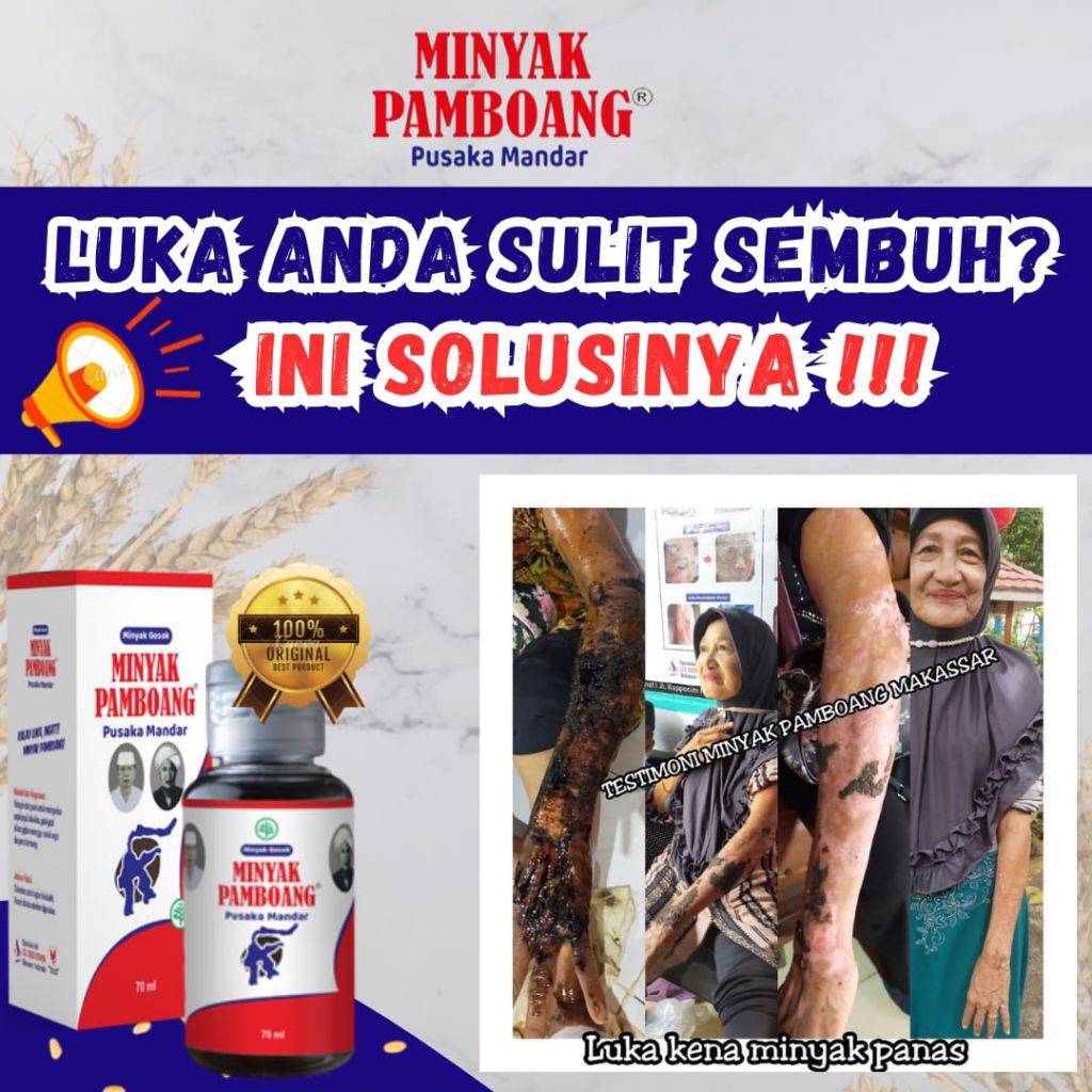 Minyak Pamboang Obat luka, Obat Luka Kena Minyak Panas, Obat luka basah, Obat luka diabetes, Obat lu