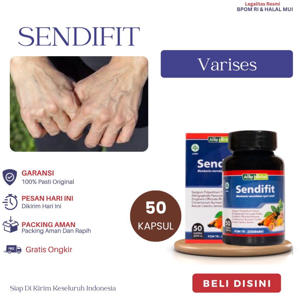 Obat Untuk Varises, Urat Murungkut, Urat Menonjol, Urat Bengkak, Urat Berkelok-Kelok, Urat Biru Urat