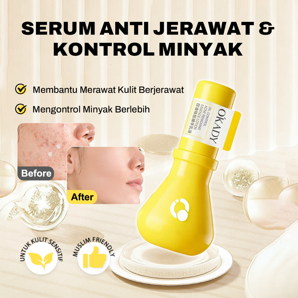 Anti Acne Serum 30ml | Serum Jerawat Spot dengan Colloidal Sulfur | Redakan Jerawat Merah, Radang & 