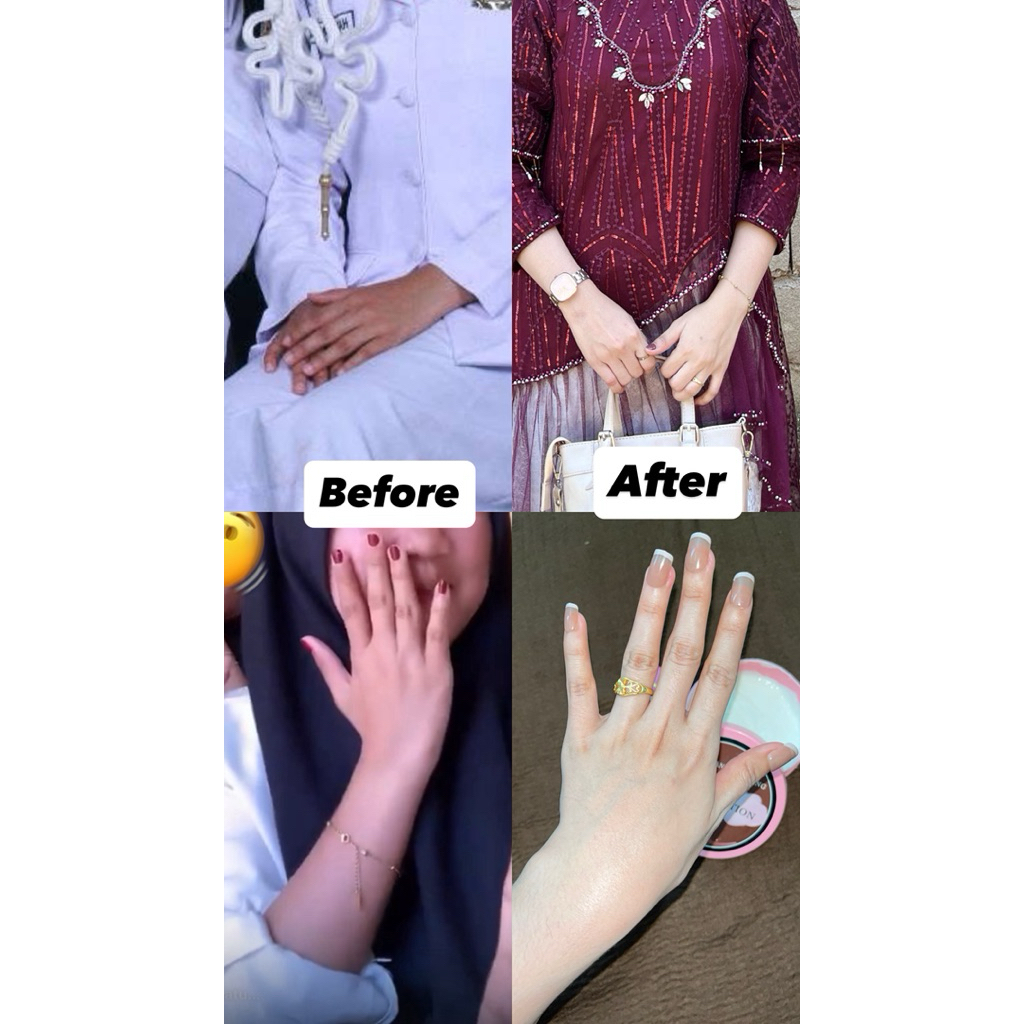 Hb racikan whitening ampuh memutihkan