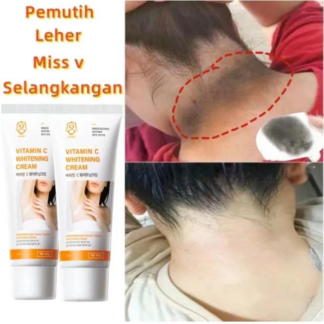 Pemutih leher dan pundak ORI Krim pemutih Vitamin C Pemutih selangkangan hitam permanen lebih cepat 