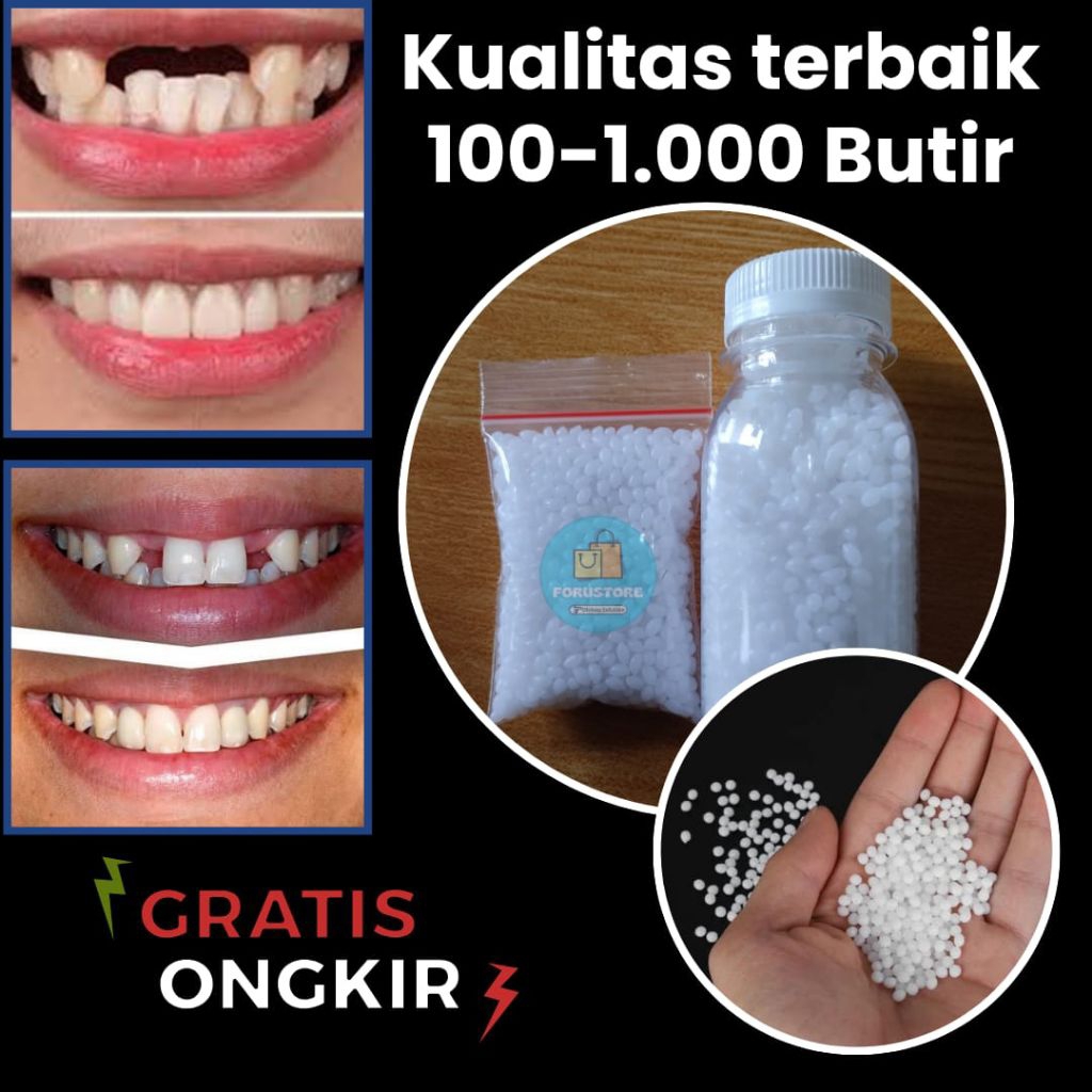100 - 1000 Butir TEMPTOOTH UNTUK MENAMBAL GIGI PATAH, GIGI BERLUBANG DAN GIGI OMPONG - Mudah Simple 