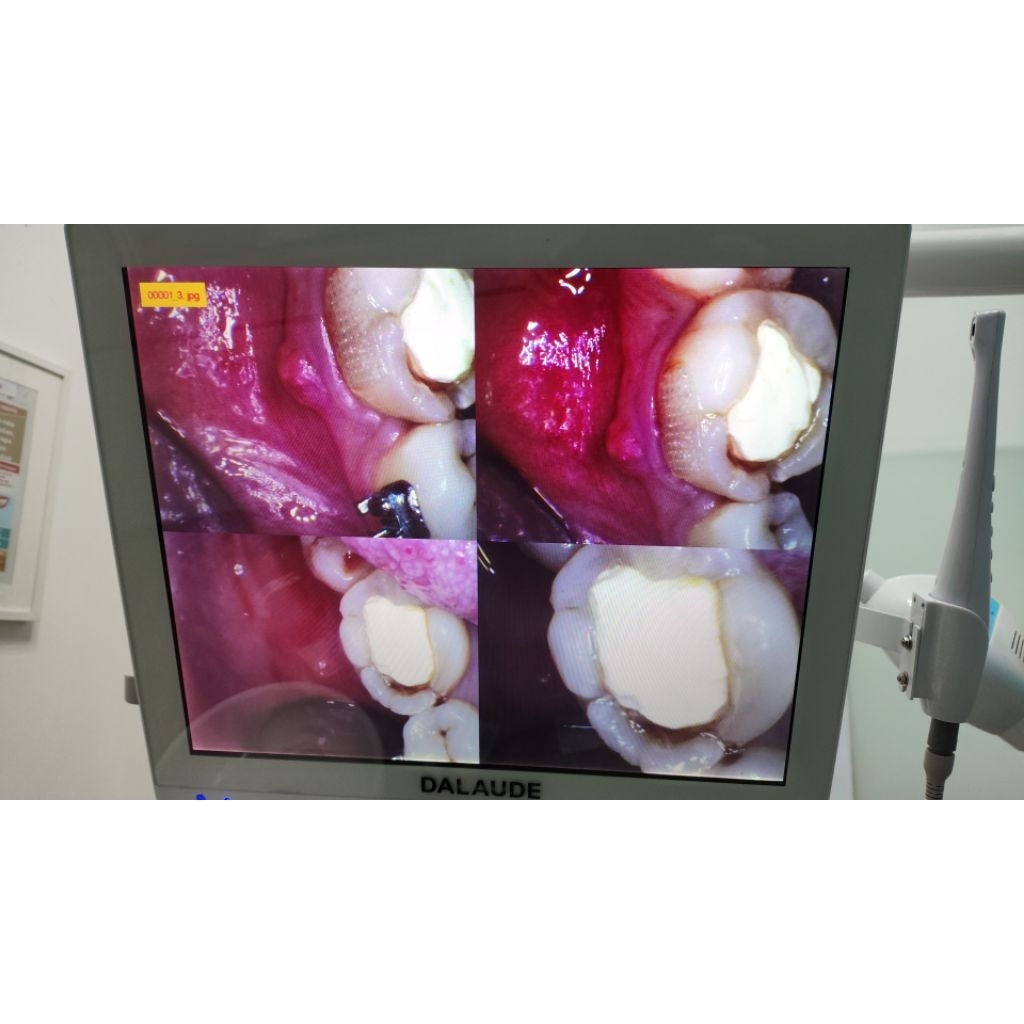 produk contoh gigi asli