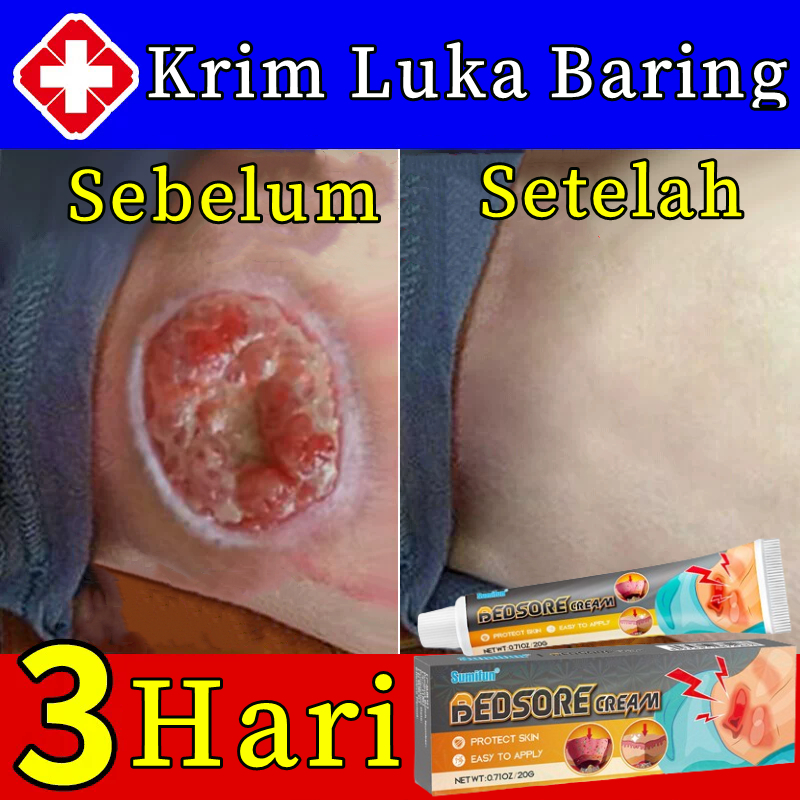 Krim salep Luka baring cepat kering Penyembuhan Luka diabetes Krim dekubitus Mengobati dekubitus