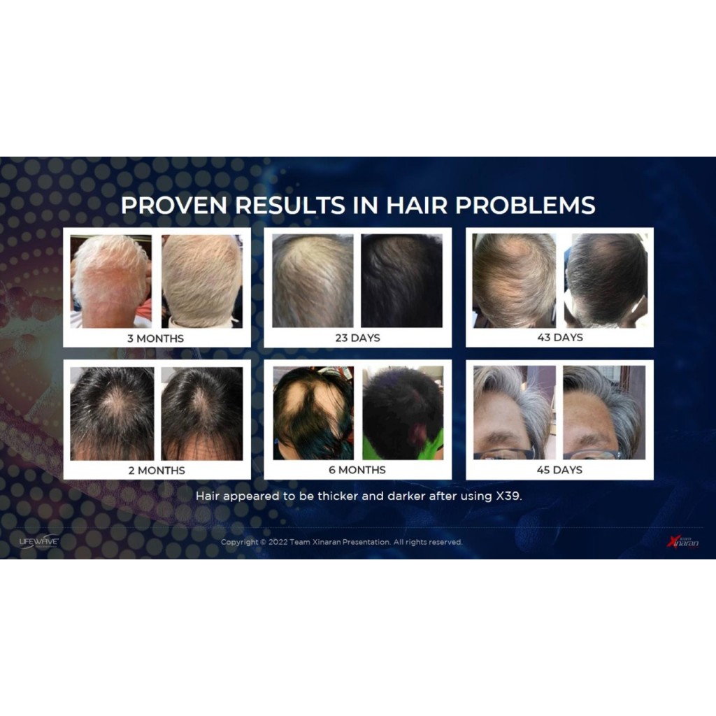 Lifewave X39 30 pcs - Rambut Mulai Menipis? Ingin rambut tumbuh alami tanpa obat & suntikan? Lifewav