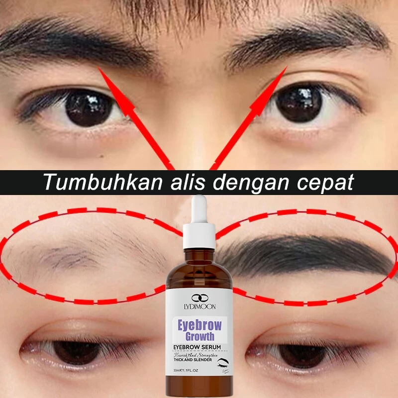 LYDIMOON Serum Penumbuh Bulu Mata Alis 30ml – Nutrisi Maksimal, Bulu Cepat Tumbuh & Sehat, Serum ali
