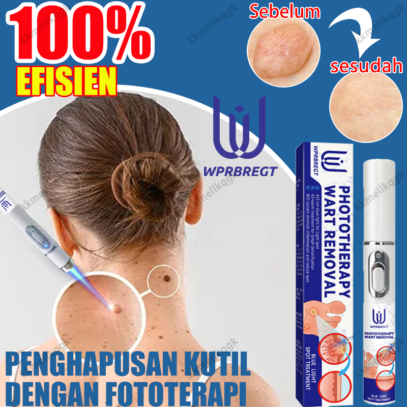 WPRBREGT-Pena Penghilang Tahi Lalat Laser Plasma - Alat Penghilang Tag Kulit / Titik Hitam / Papilom