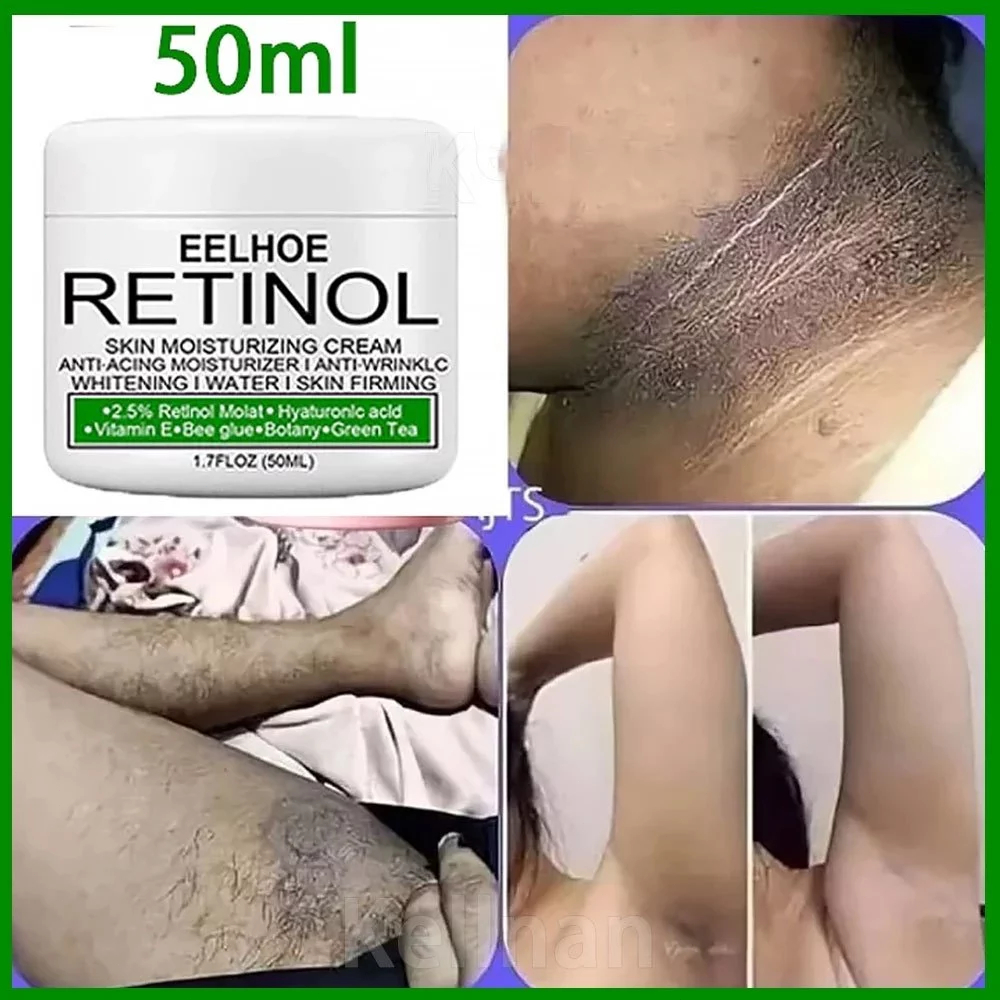 Krim Pemutih Ketiak Pemutih Selangkangan Vagina Pembersih Selangkangan Hitam Krim Pemutih Ketiak Pem