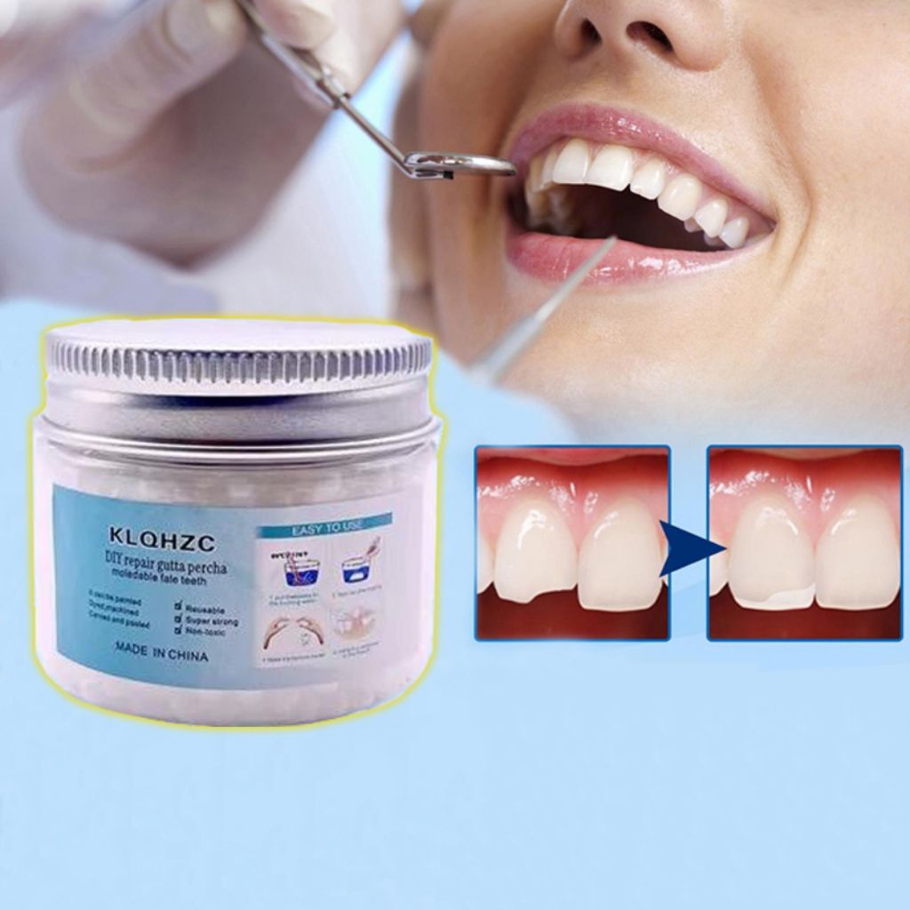 Temptooth 200 butir Original Penambal Gigi isi 200 butir Berlubang Asli Dokter permanen Tambala