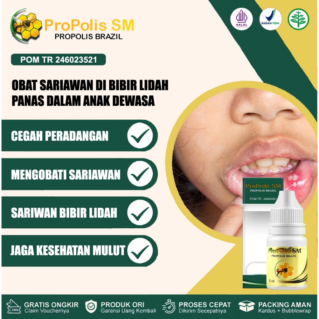 Obat Sariawan Anak Dewasa Sariawan Bibir, Menahun, Radang Sariawan, Sariawan Mulut, Sariawan di Teng