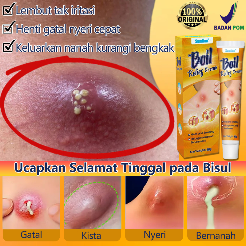 Oba bisul ampuh Salep bisul bernanah Salep jamur kulit 20g Salep pengobatan bisul Pereda nyeri Anti 