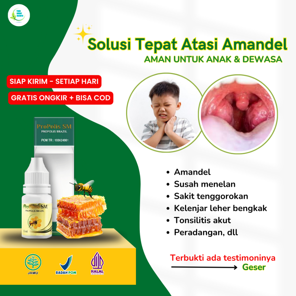 Obat Tetes Amandel Pengempes Amandel Bengkak Tonsilitis Akut Buat Anak dan Dewasa