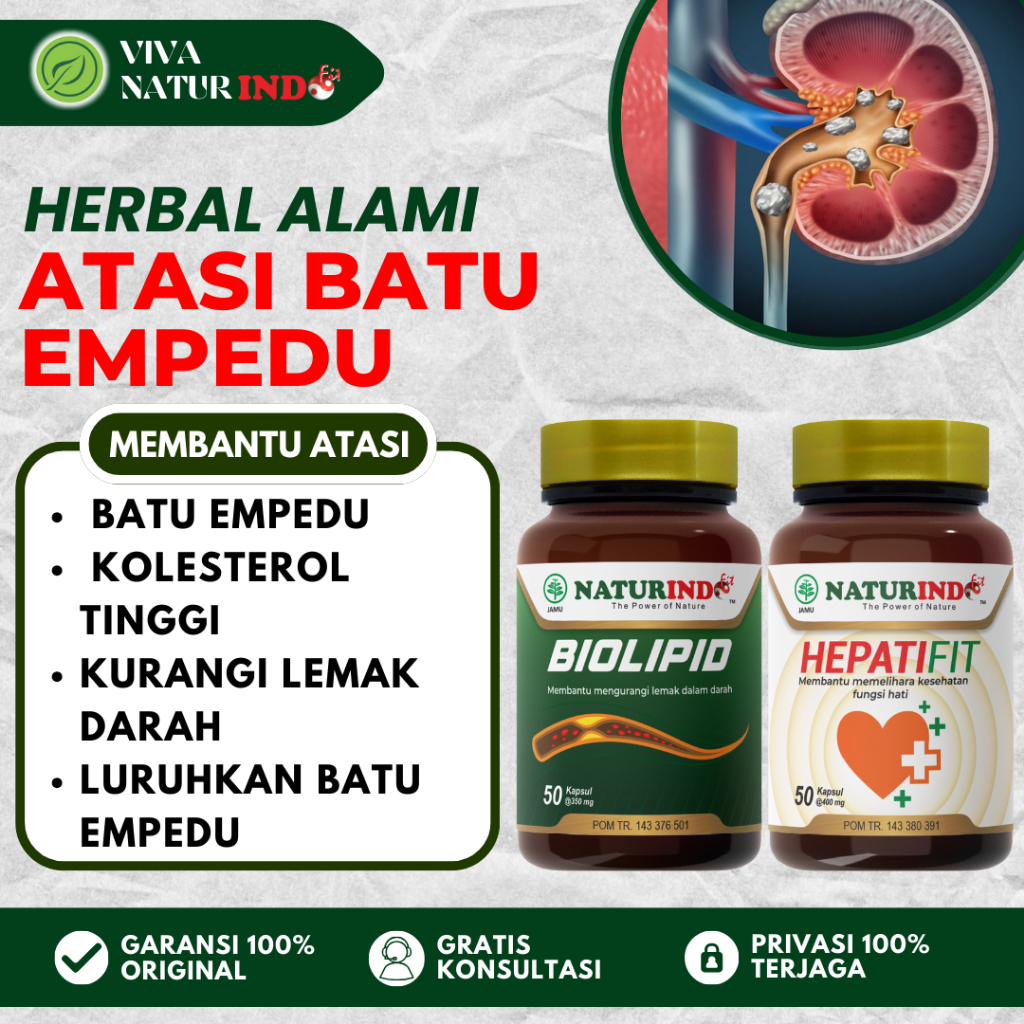 Oba Herbal Penghancur Batu Empedu Luruhkan Batu Empedu Atasi Batu Empedu Tanpa Operasi Naturindo