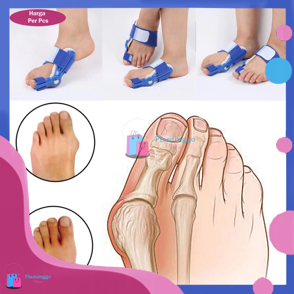 INSOLE KAKI BUNION DAN HALLUX VALGUS CORRECTOR KAKI BUNION INSOLE JARI KAKI BENGKOK TERAPI BUNION SP