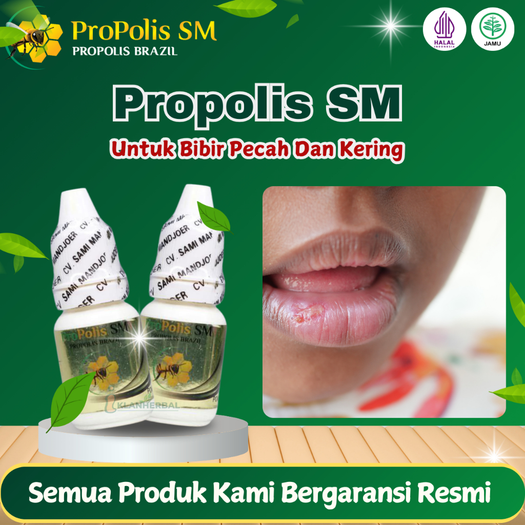 Propolis SM - Obat Bibir Pecah Dan Kering, Bibir Hitam, Bibir Kering San Bengkak