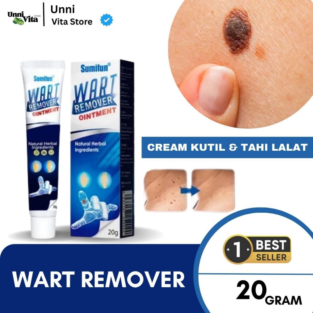 Obat Tahi Tai Lalat Penghilang Tahi Lalat Hidup Mati Original Wart Removal 20g Asli
