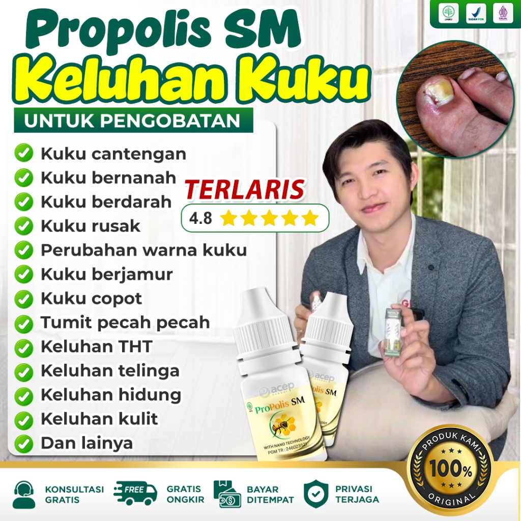 Obat Kuku Jamur dan Rusak Original Kaki Pecah Pecah Kuku Cantengan Bernanah Berjamur Propolis SM