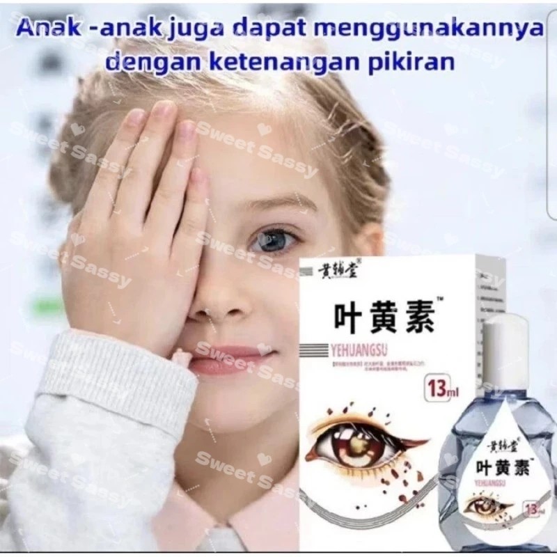 Yehuangsu Obat Tetes Mata No 1 Dijepang Obat Tetes Mata Berlemak Kekuningan Penyakit Pterigium Gluko