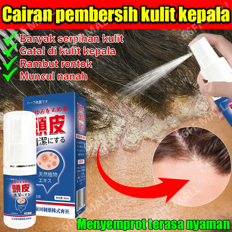 obat ketombe anti ketombe penghilang ketombe paling ampuh dermatitis seboroik obat jamur kepala psor