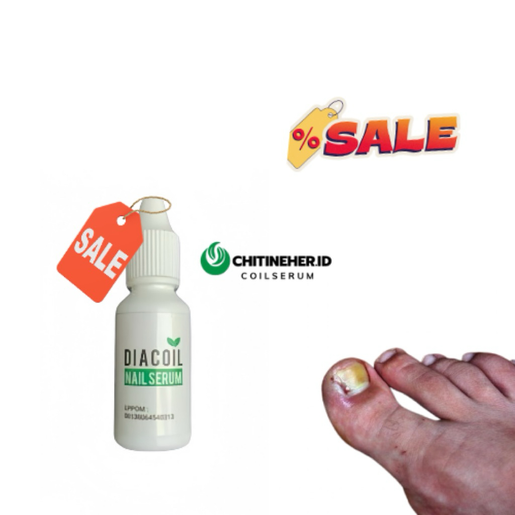 DIACOIL NAIL SERUM ORIGINAL | OBAT JAMUR KUKU |  CANTENGAN DAN BERNANAH | AMPUH 100%