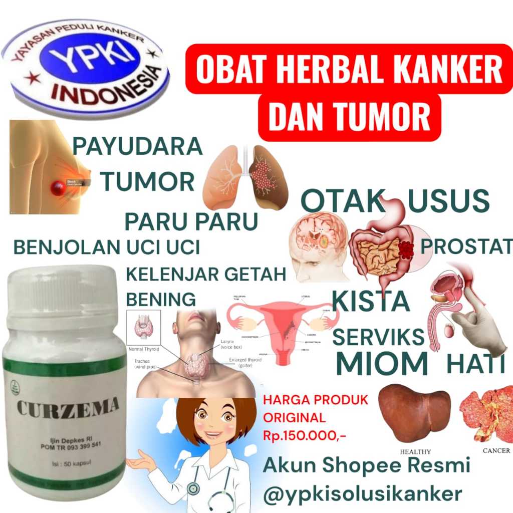 CURZEMA YPKI ll OBAT KANKER USUS BESAR STADIUM 3 ll OBAT KANKER USUS BESAR STADIUM 4 ll OBAT LUKA KA