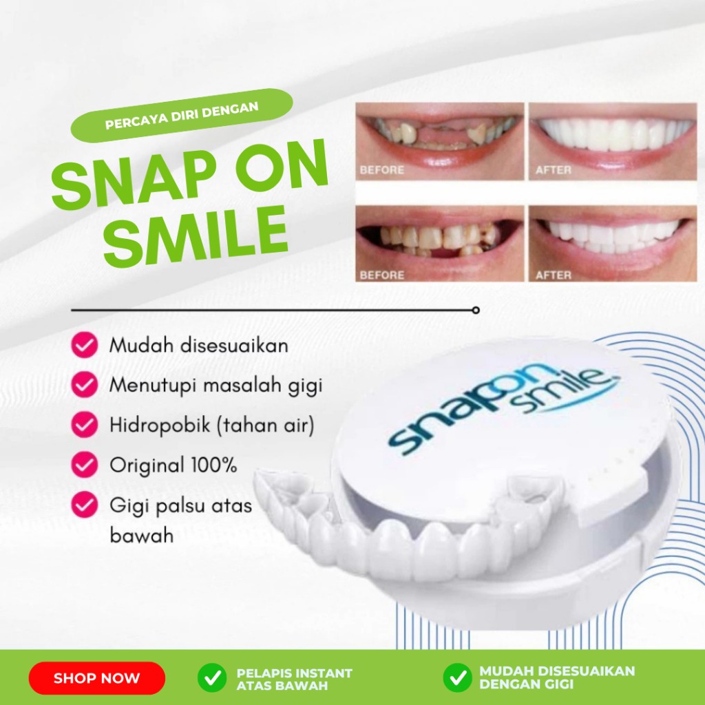 COD Snap On Smile Gigi Silikon 100 % Original Snap On Smile 1 Set atas bawah