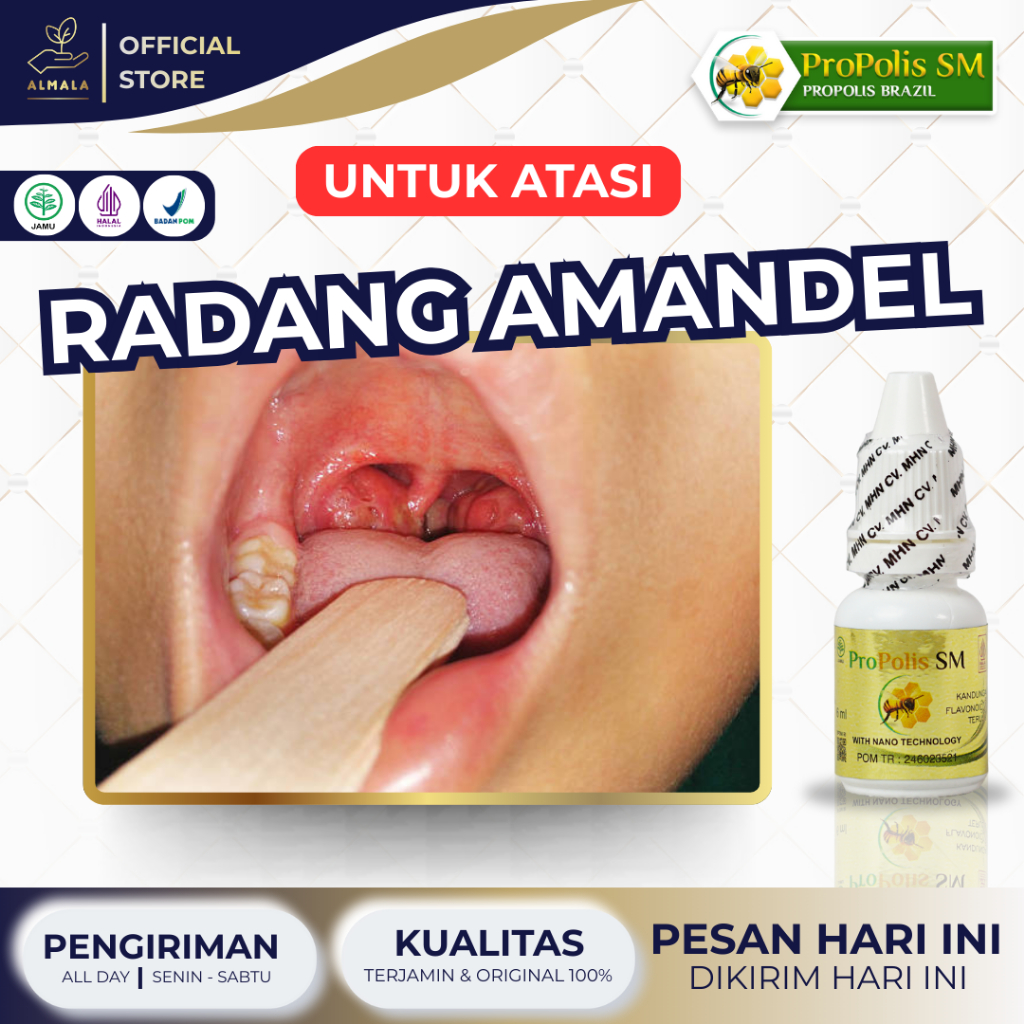 Obat Radang Amandel, Amandel Anak & Dewasa, Amandel Bengkak, Pengempis Amandel, Amandel Akut - ProPo