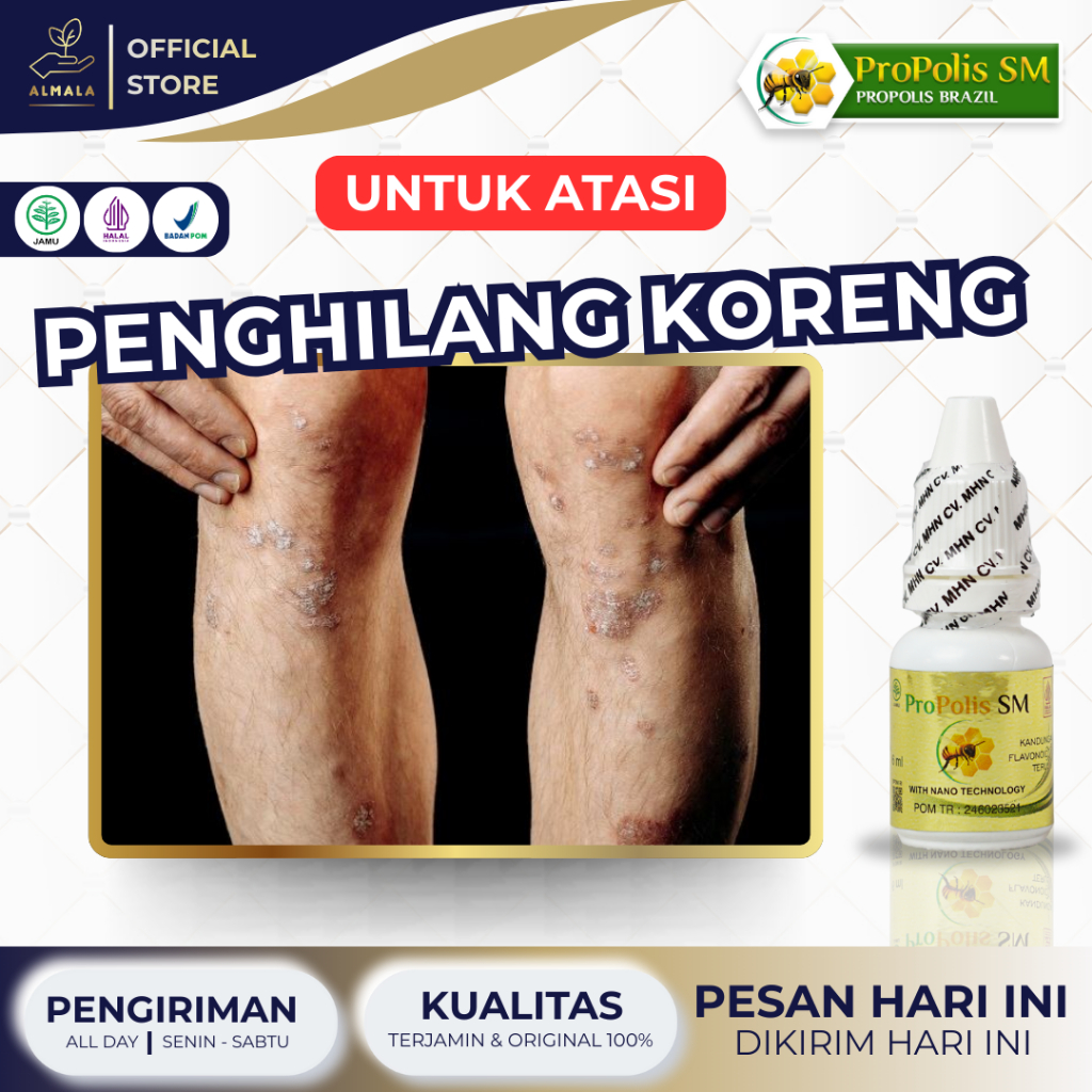 Obat Penghilang koreng di kaki, Penghilang bekas koreng, Bekas luka koreng - Propolis SM ORIGINAL