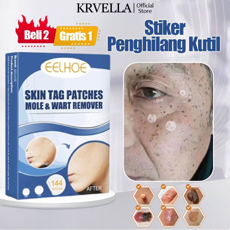 KRVELLA Stiker Penghilang Kutil Dan Tahi Lalat Penghilang Kutil Di Wajah Dan Leher Patch Jerawat Ple
